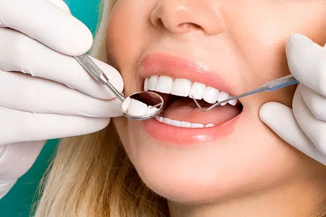 Facetas Dentárias - Carlos Gomes Odontologia - Blumenau, SC