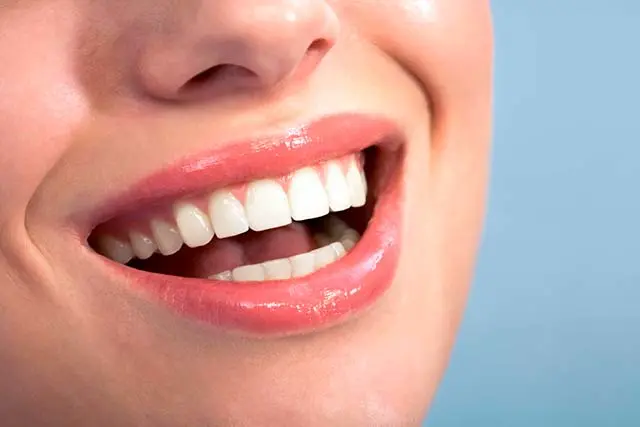 Lentes Dentárias - Carlos Gomes Odontologia - Blumenau, SC