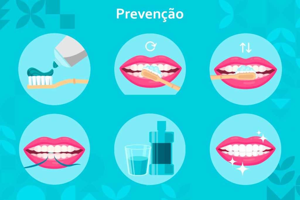 Na Periodontia o Melhor Remédio é a Prevenção. - Carlos Gomes Odontologia em Blumenau/SC.