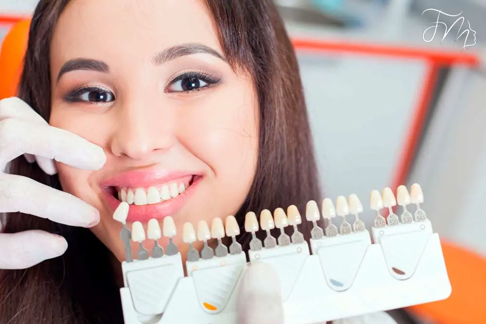 O que São Facetas Dentárias, Lentes de Contato? - Carlos Gomes Odontologia em Blumenau/SC