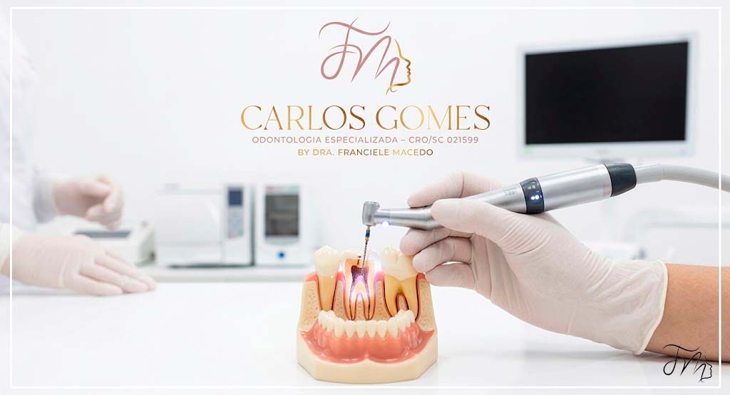 Especialistas em Tratamento de Canal em Blumenau - Carlos Gomes Odontologia