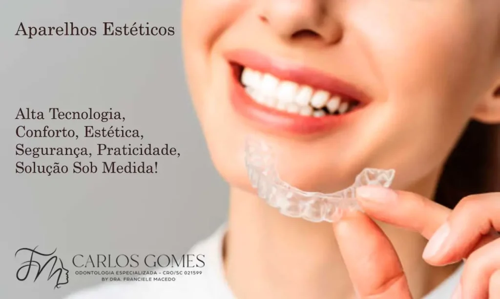 Alinhador Estético em Blumenau: Alta Tecnologia, Conforto, Estética, Segurança. - Carlos Gomes Odontologia.