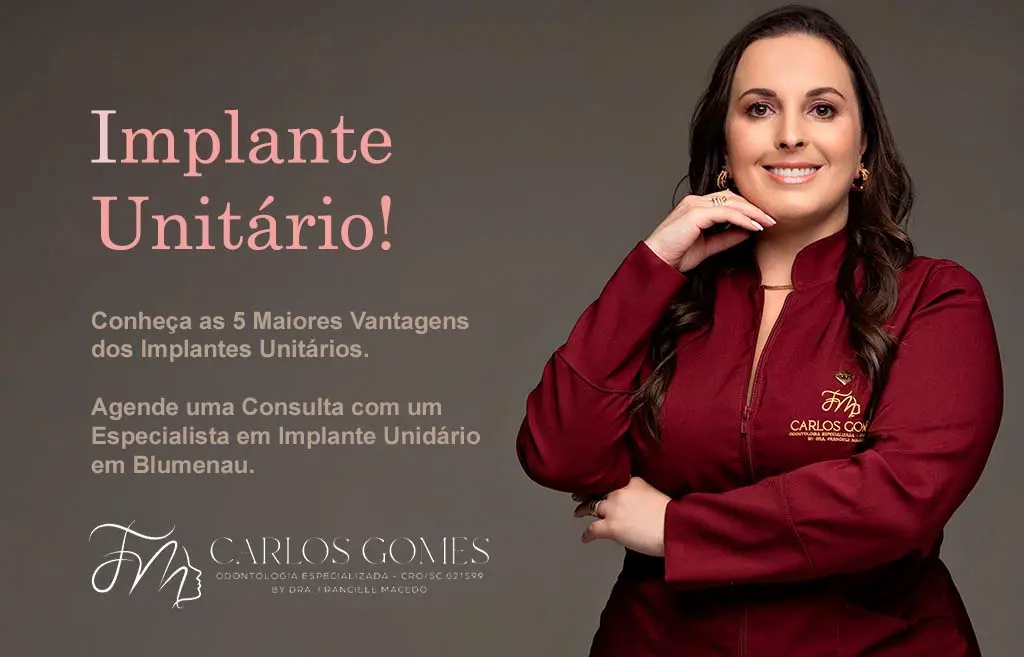 Conheça as 5 Vantagens do Implante Unitário em Blumenau na Carlos Gomes Odontologia.