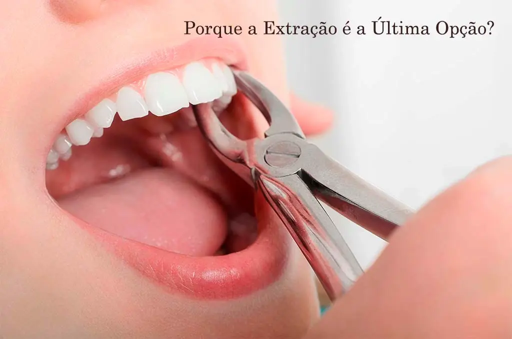 Por que a Extração Dentária é a Última Opção?