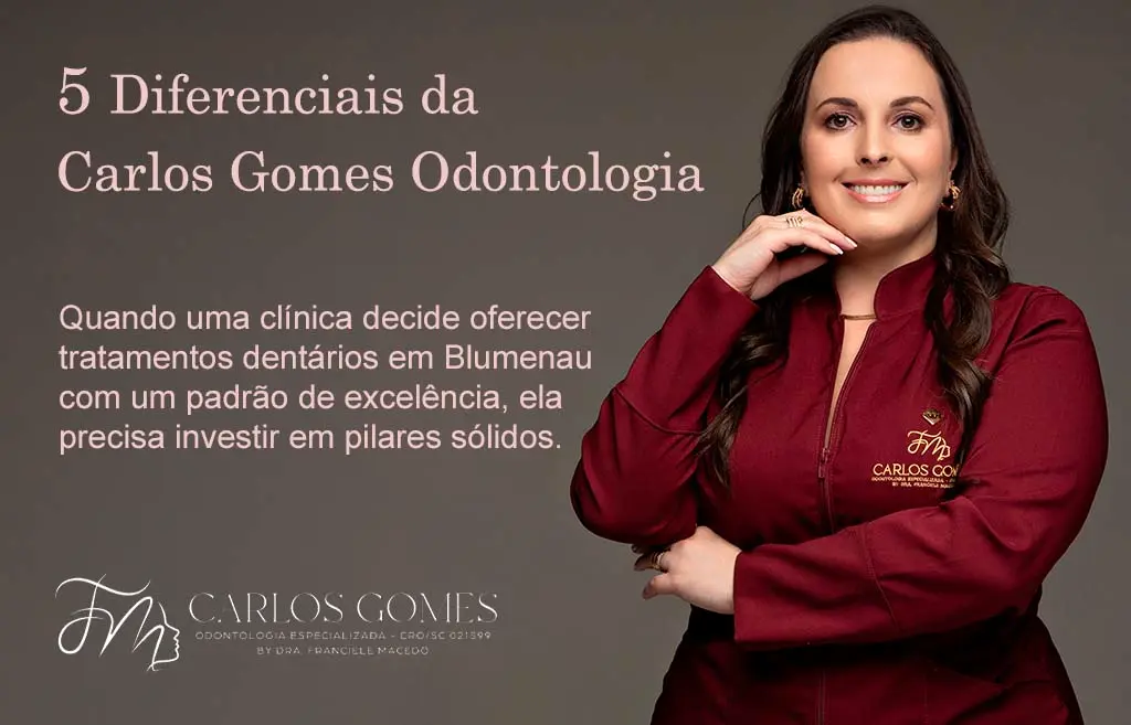 Conheça os Principais Tratamentos Dentários em Blumenau, e os 5 Diferenciais da Carlos Gomes Odontologia