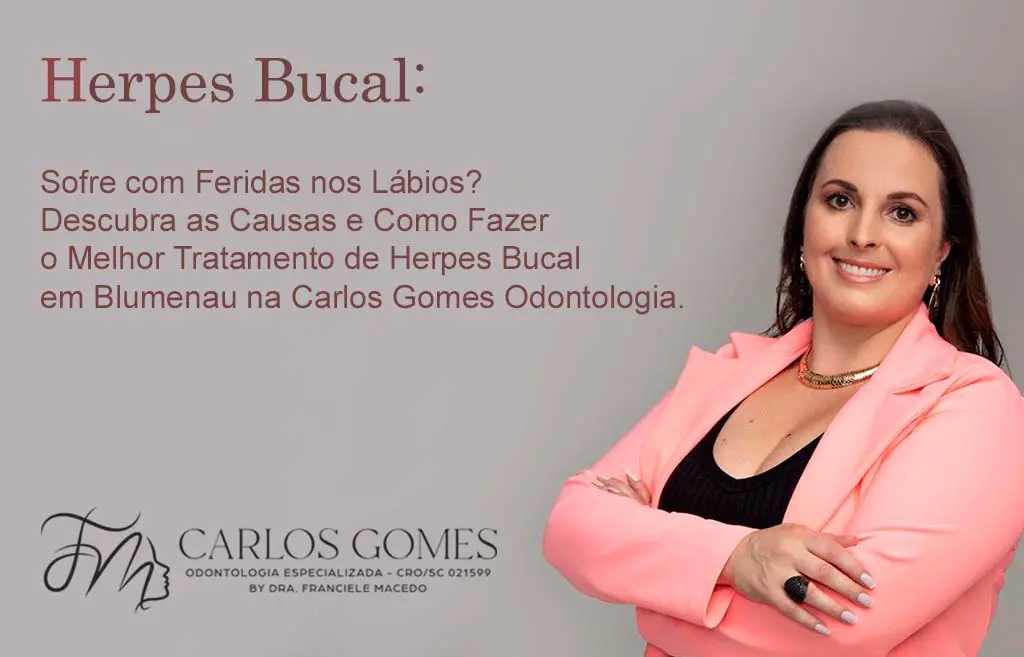 Herpes Bucal, O que é? Prevenção, e Tratamento de Herpes Bucal em Blumenau. - Carlos Gomes Odontologia.