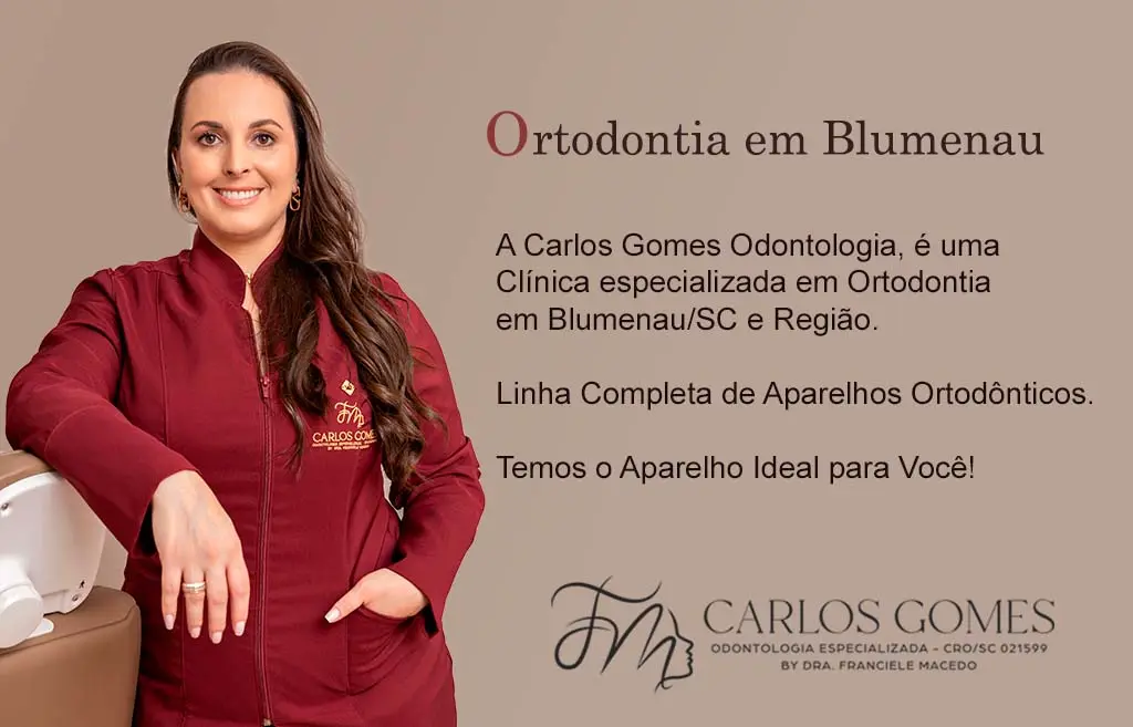 Ortodontia em Blumenau: Conquiste o Sorriso Alinhado que Você Sempre Sonhou! - Carlos Gomes Odontologia.