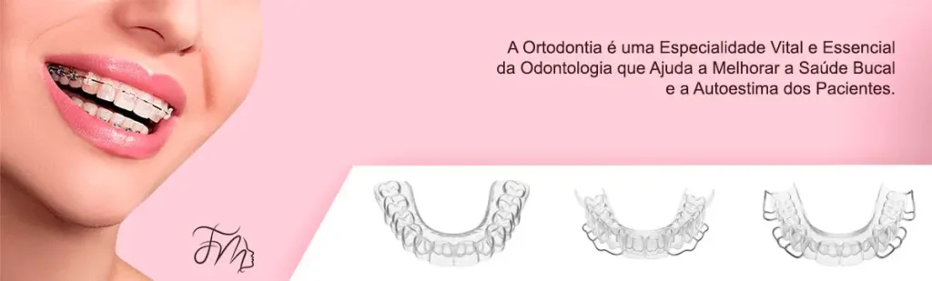 Ortodontia em Blumenau e Região - Carlos Gomes Odontologia.