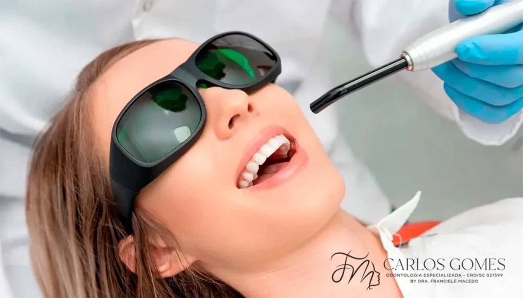 O que é, e Como Funciona o Tratamento com Laserterapia em Blumenau? - Carlos Gomes Odontologia.